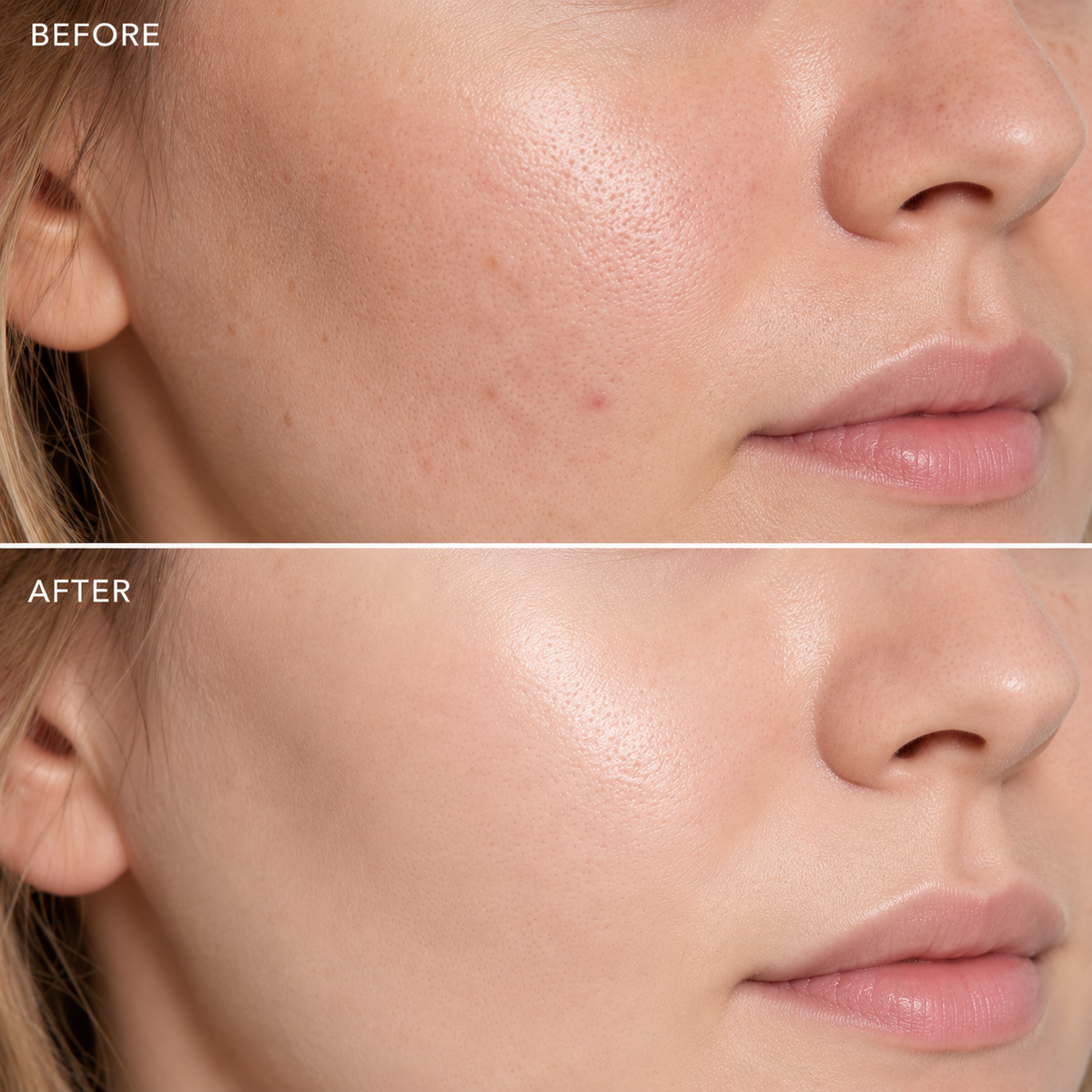 LemonBottle Skin Booster